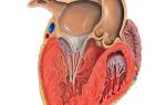 Гипертензия левого желудочка сердца что это такое