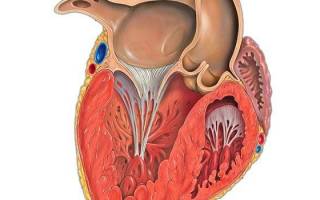 Гипертензия левого желудочка сердца что это такое