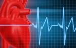 Аритмия сердца причины лечение народными средствами