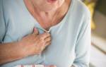 Признаки инфаркта миокарда у женщин