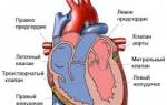 Недостаточность сердечных клапанов