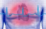 Виды сердечной аритмии