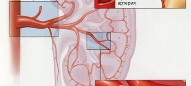 Вазоренальная гипертензия развивается вследствие